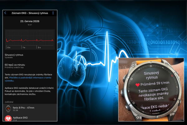 Měření EKG