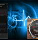 Měření EKG